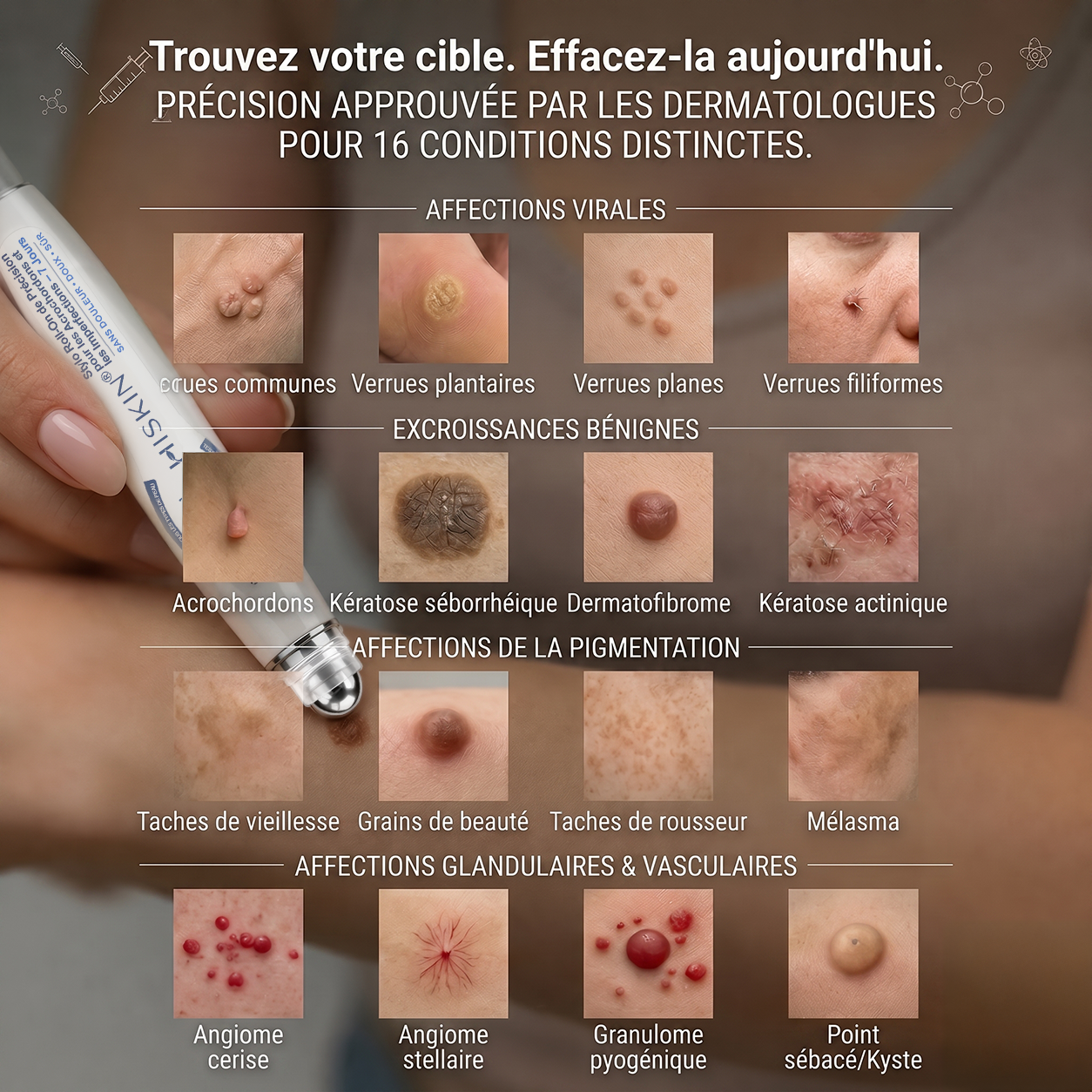 Boutique officielle de la marque 🔊 HISKIN® 7 Jours Effaceur de taches et d’excroissances cutanées(Zéro douleur, zéro cicatrice – Roller)