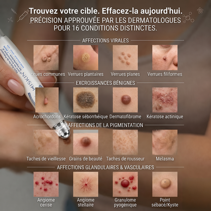 Boutique officielle de la marque 🔊 HISKIN® 7 Jours Effaceur de taches et d’excroissances cutanées(Zéro douleur, zéro cicatrice – Roller)