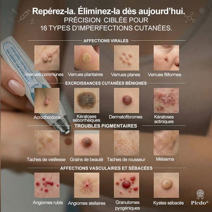 Boutique officielle de la marque 🔊 𝐏i𝐜𝐝o® 7 Jours Effaceur de taches et d’excroissances cutanées(Zéro douleur, zéro cicatrice – Roller)