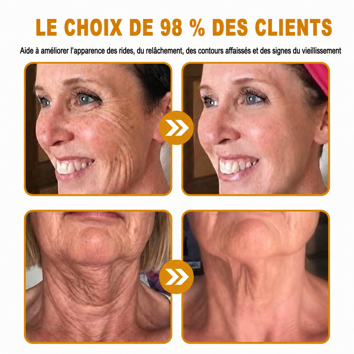 HISKIN® Golden Silk Protein Peptide Beauty Pen — Soin beauté ciblé pour les rides, le contour des yeux et les lèvres | Résultats visibles dès 3 jours ✨
