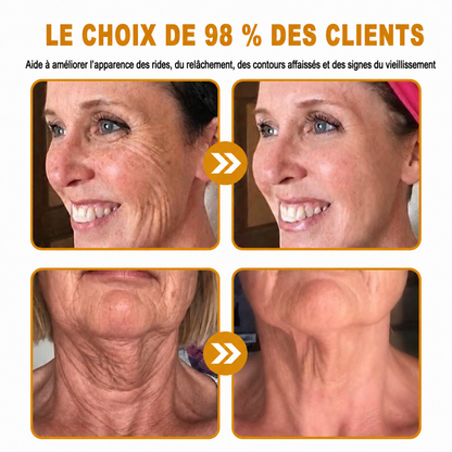 HISKIN® Golden Silk Protein Peptide Beauty Pen — Soin beauté ciblé pour les rides, le contour des yeux et les lèvres | Résultats visibles dès 3 jours ✨