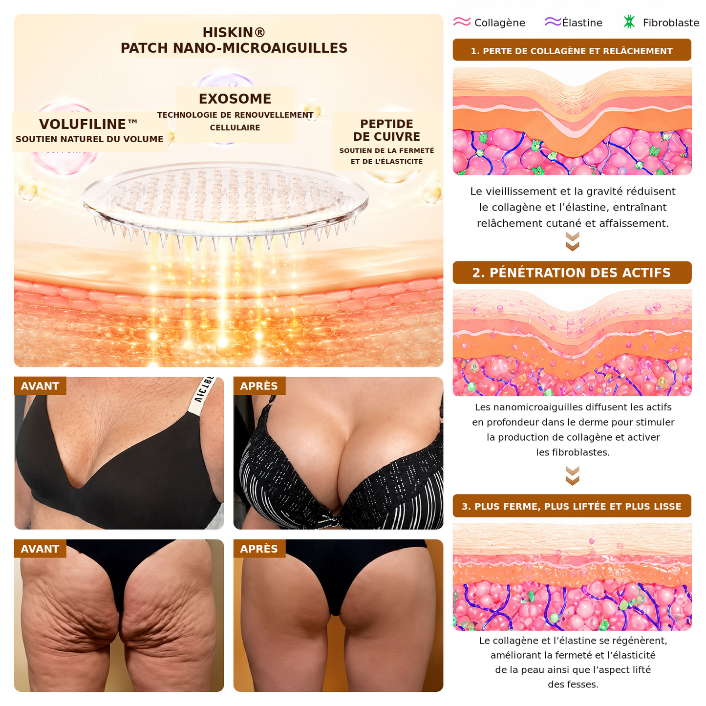 HISKIN® Patch à nano-microaiguilles pour le volume, le galbe et la fermeté de la poitrine – Formule Volufiline™ + Exosomes + Peptides de cuivre, enrichie par la technologie de renouvellement cellulaire